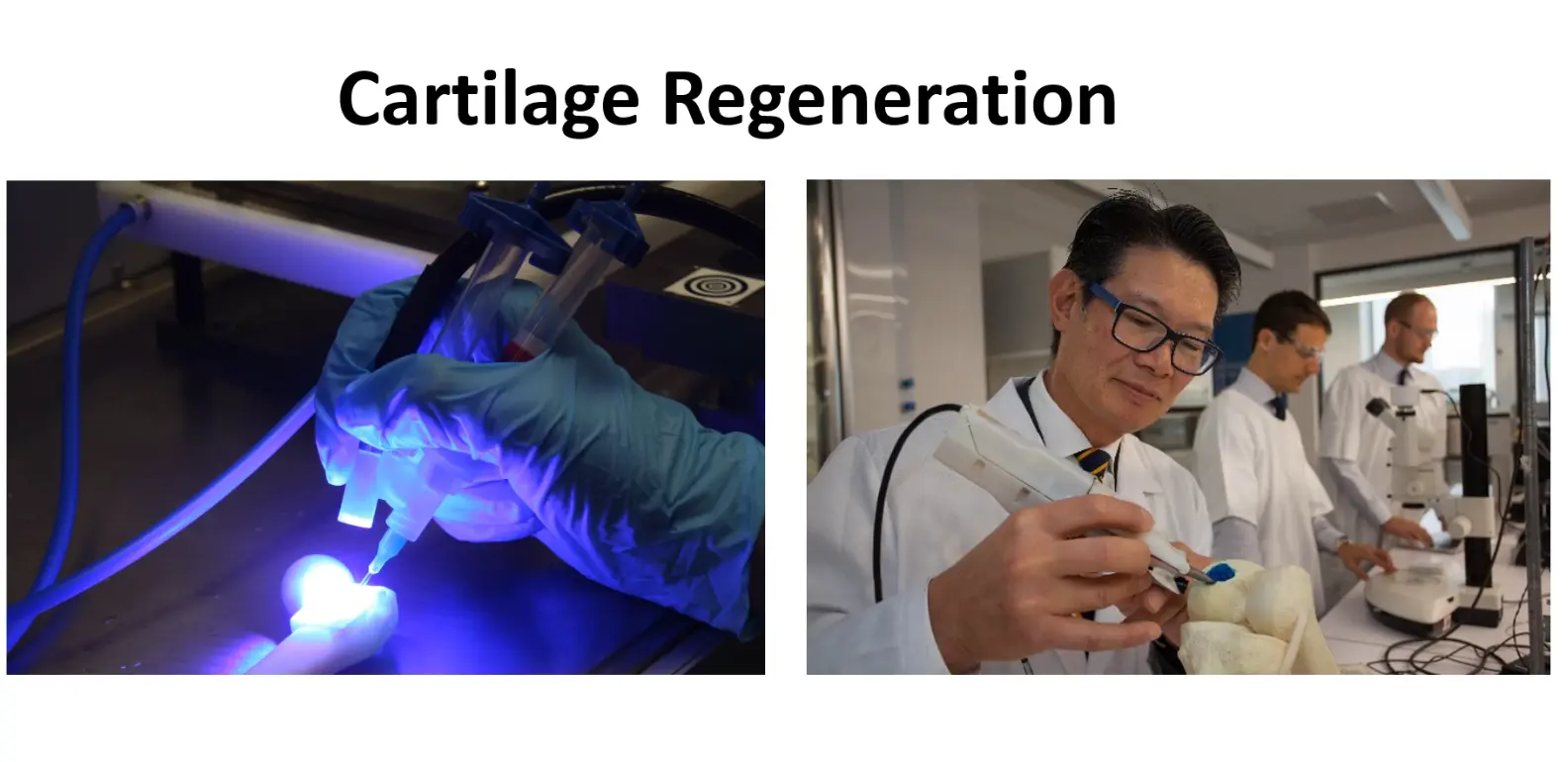 Cartilage Regeneration